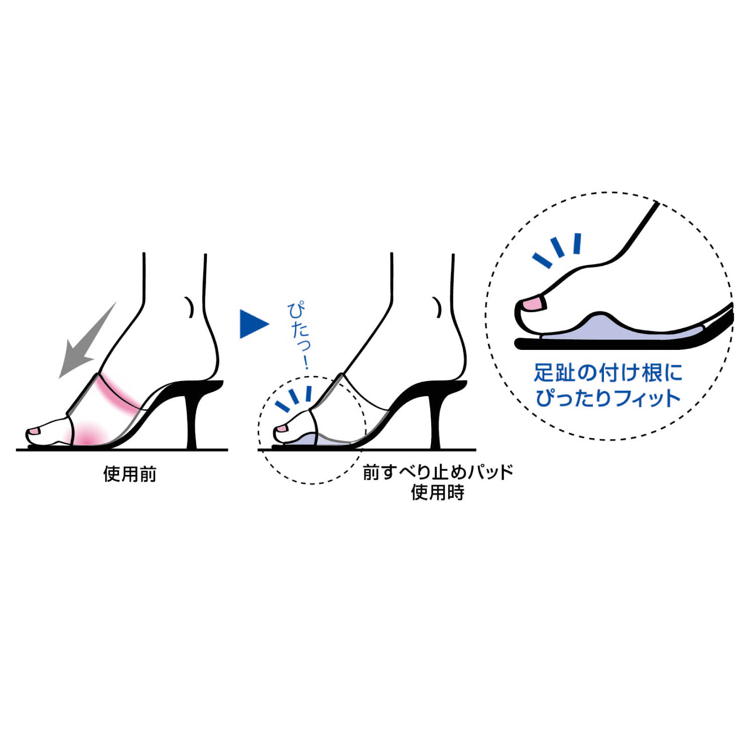 前すべり止めパッド アーチフィッター 通販のベルメゾンネット 前すべり止めパッド アーチフィッター 通販のベルメゾンネット