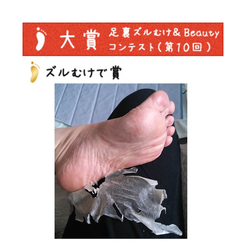 ベストヒット受賞 ベビーフットイージーパックｄｐ６０分タイプ 通販のベルメゾンネット