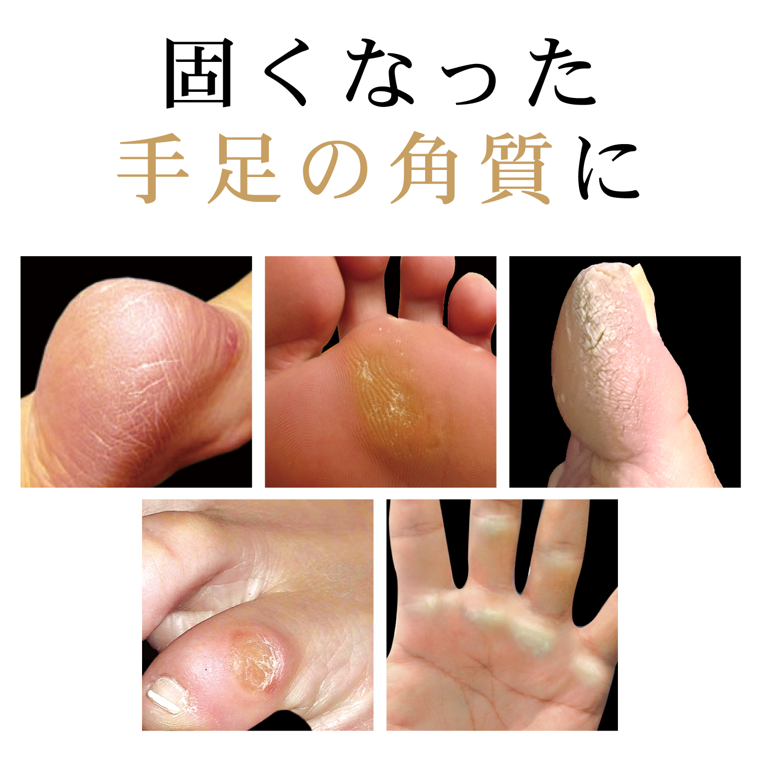 ピンポイント角質取り タコトリーs 通販のベルメゾンネット ピンポイント角質取り タコトリーs 通販のベルメゾンネット