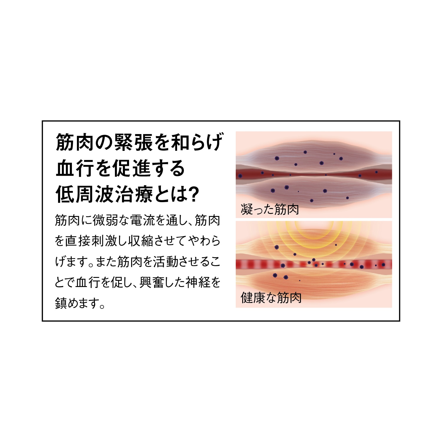 家庭用低周波治療器 ｏｎｔｏｕ（おんとう）（マッサージ機/ボディケア