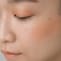 曙