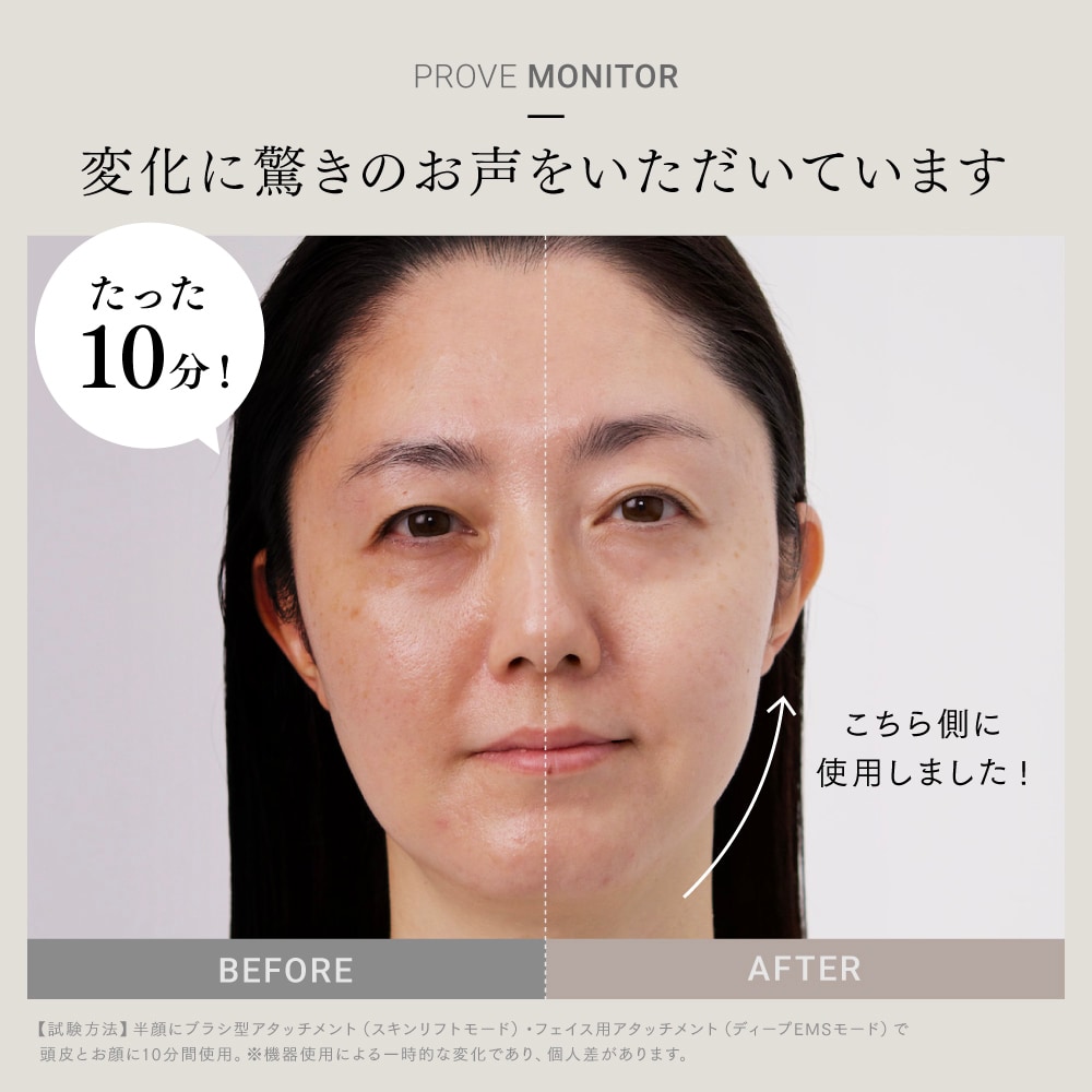 10％キャッシュバック】 プルーヴ (リフトアップ美顔器)(マイ